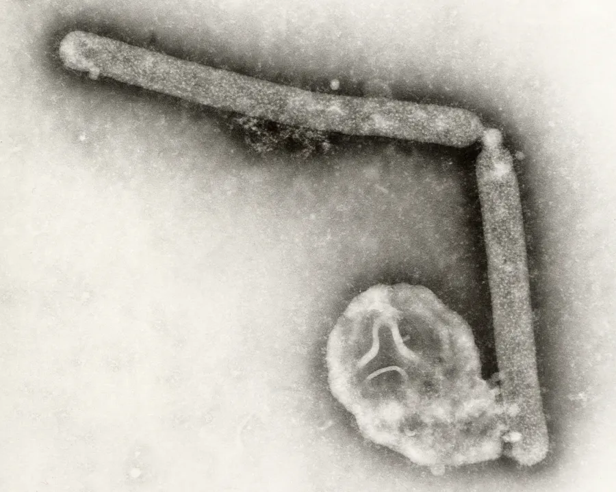 Microscopic view of a virus with a filamentous structure and a spherical component.